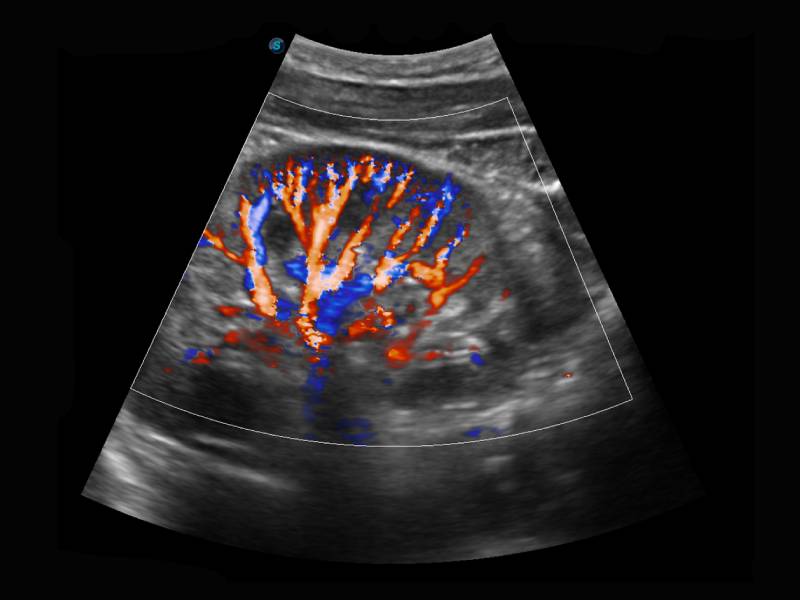 Color Doppler Ultrasound Ahmedabad